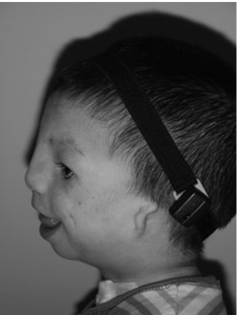 ear